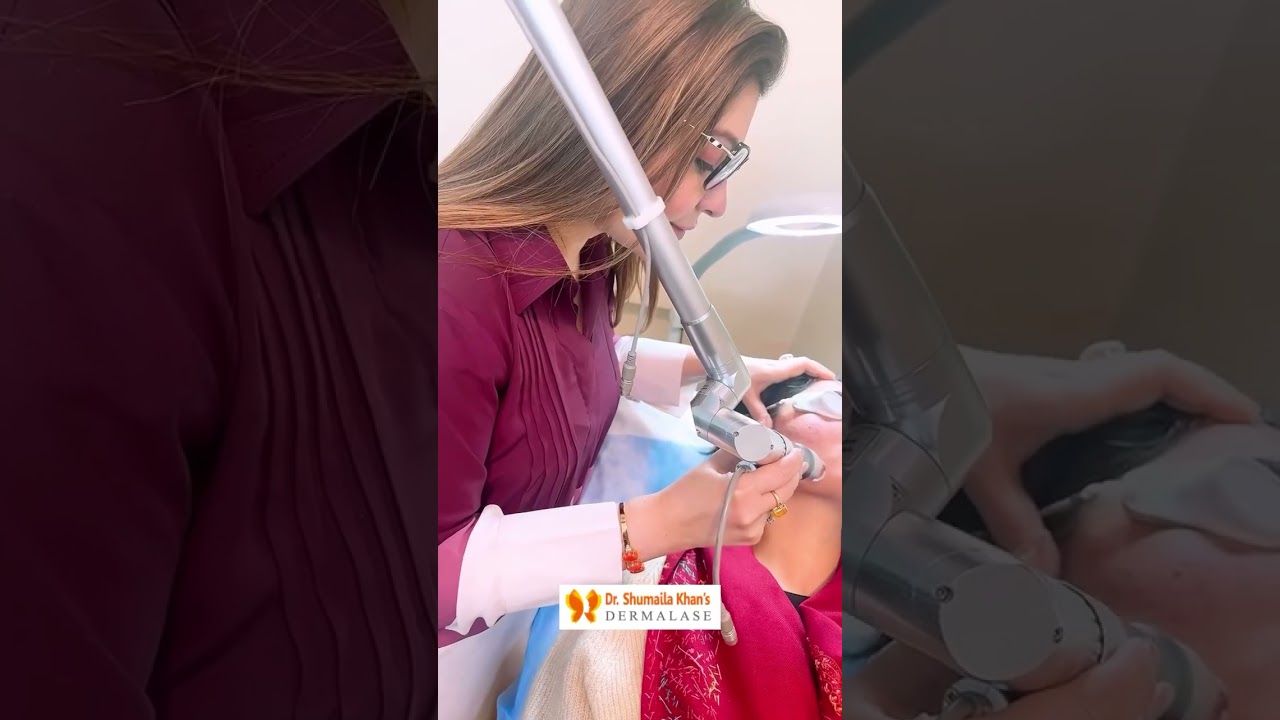 Pico Fractional Laser Resurfacing in Islamabad | Best Aesthetic Clinic | Dr. Shumaila Khan