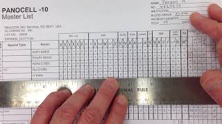 Blood Bank - Antibody Identification I