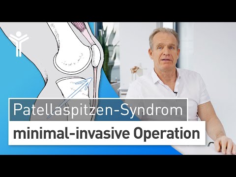 Video: Wächst die Patellasehne nach?