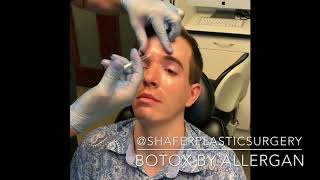 Botox By Allergan | Shafer Plastic Surgery screenshot 3
