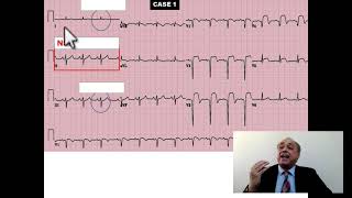 EKG Trainer Case (1) #internalmedicine #cme #internalmedicinelectures #medlearn #medicalcollege #... screenshot 5
