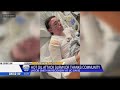 Yuba City McDonald's burn victim thanks community from hospital