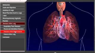 Lung Module Medtrainer - Medical Animation Studio