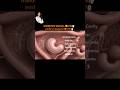 3 Weeks Pregnant😱What Does Baby Look Like Inside the Uterus? | Educational Only #DrShivangiWellness