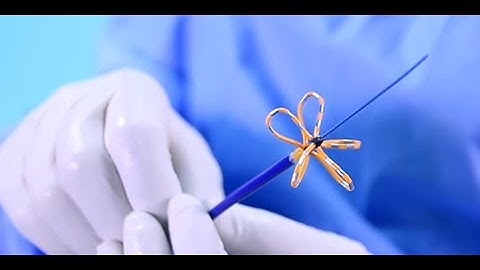 Pulse Field Abaltion with EnSite 3D mapping