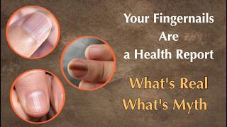 Your Fingernails Are a Health Report — What's Real, What's Myth screenshot 2