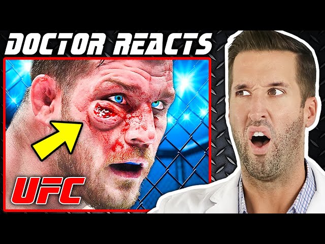 ER Doctor REACTS to Worst MMA Injuries in UFC History class=