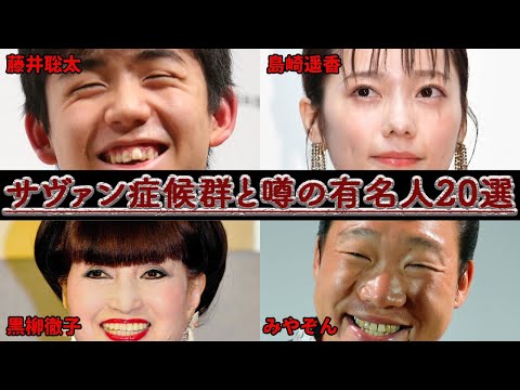【天才⁉】サヴァン症候群 と噂されている有名人20選