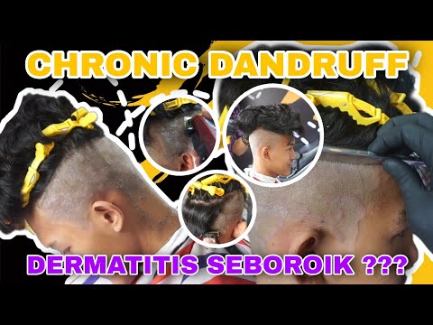 Kulit Mati Kepala