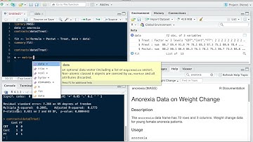 Coding user defined contrasts in R