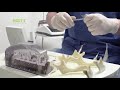 RootForm dental implant placement. Hands on with Dr. El Moheb