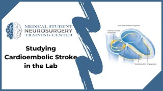 Studying Cardioembolic Stroke in the Lab