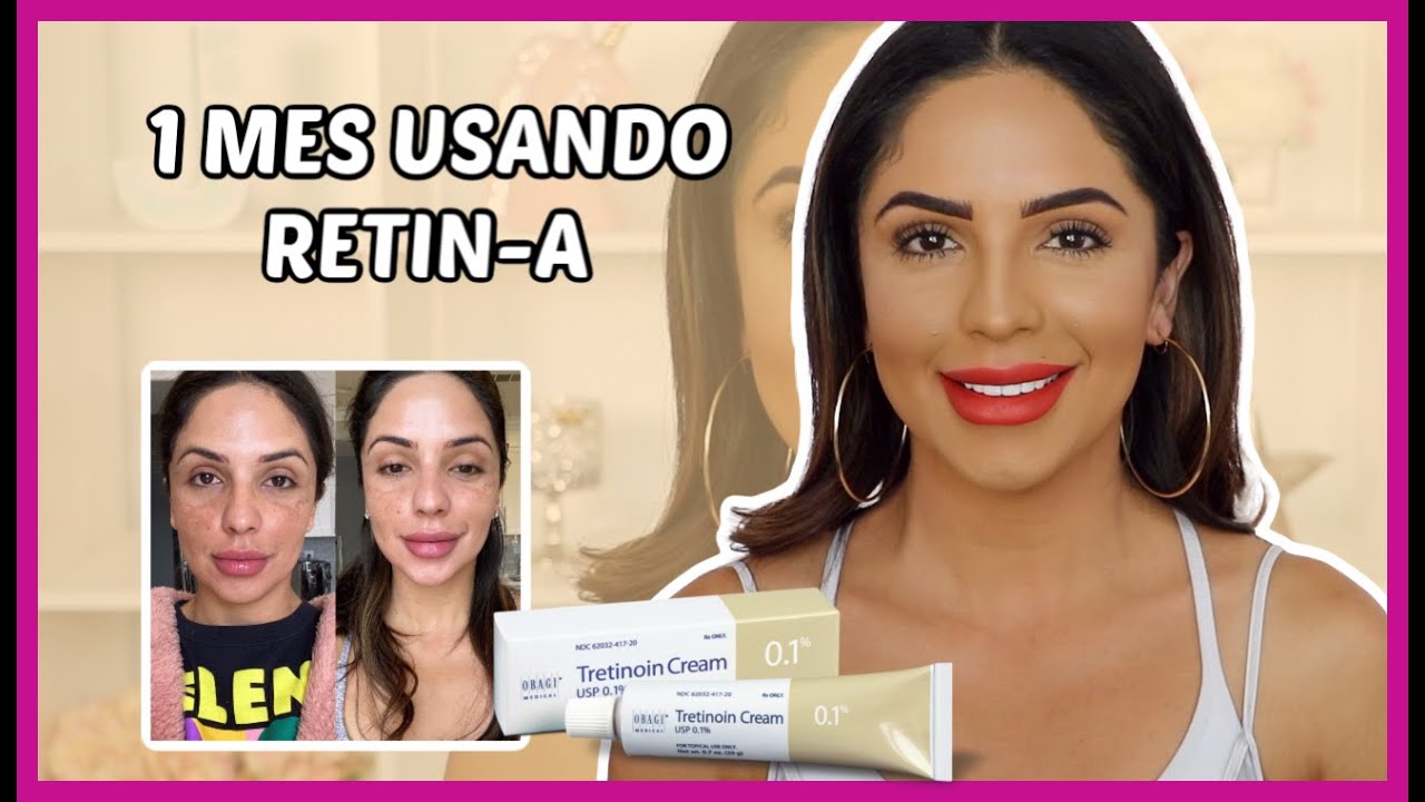 1 MES USANDO RETINA. QUE CAMBIOS EH NOTADO? LO BUENO, LO MALO Y SUS