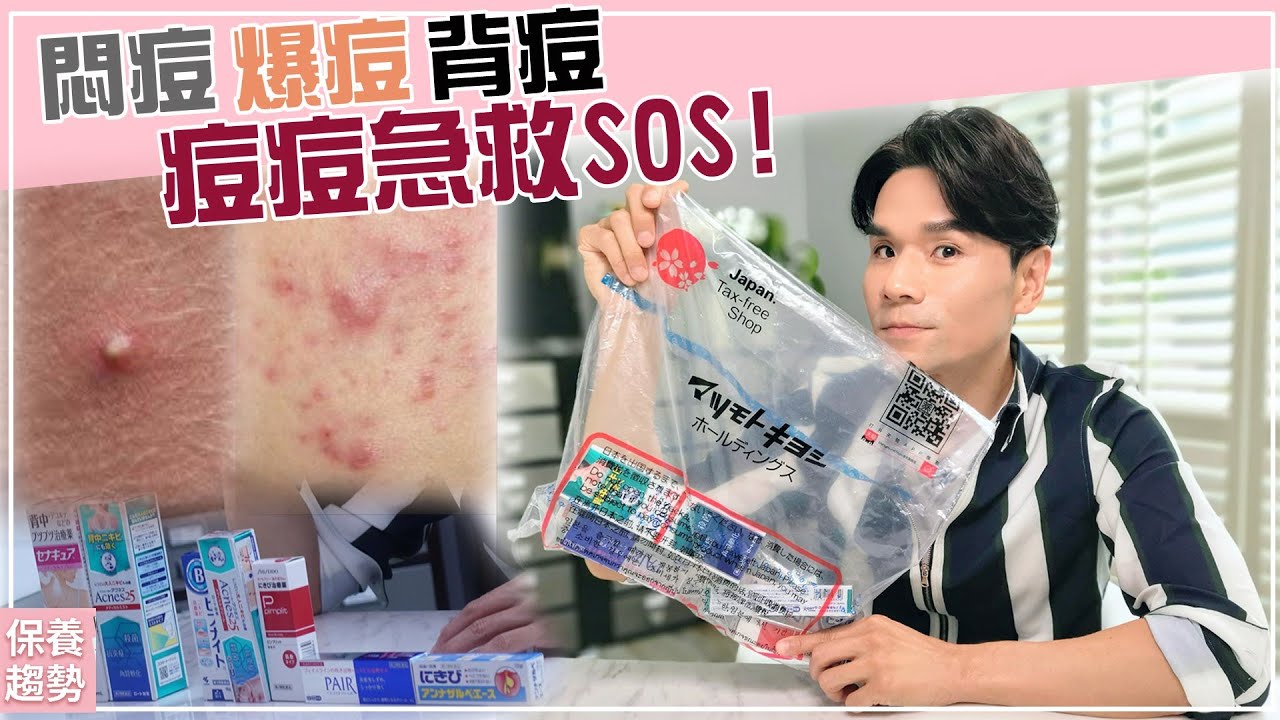 日本藥妝痘痘急救悶痘 爆痘 背後痘得救了 Ll Kevin想得美ll Acne Medicine Haul Youtube 日本藥妝痘痘急救悶痘 爆痘 背後痘得救了 Ll Kevin想得美ll Acne Medicine Haul Youtube