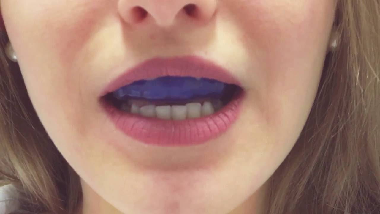 Speaking wearing mouthguard YouTube