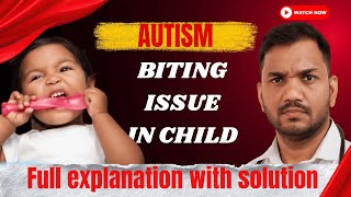Biting Issue in Children? Understanding Why Children Bite & How to Respond