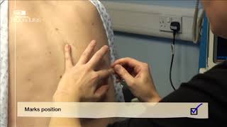 HTPCP DVD2 Title 10 01 Pleural Aspiration HTPCP DVD2 Title 10 01 Pleural Aspiration
