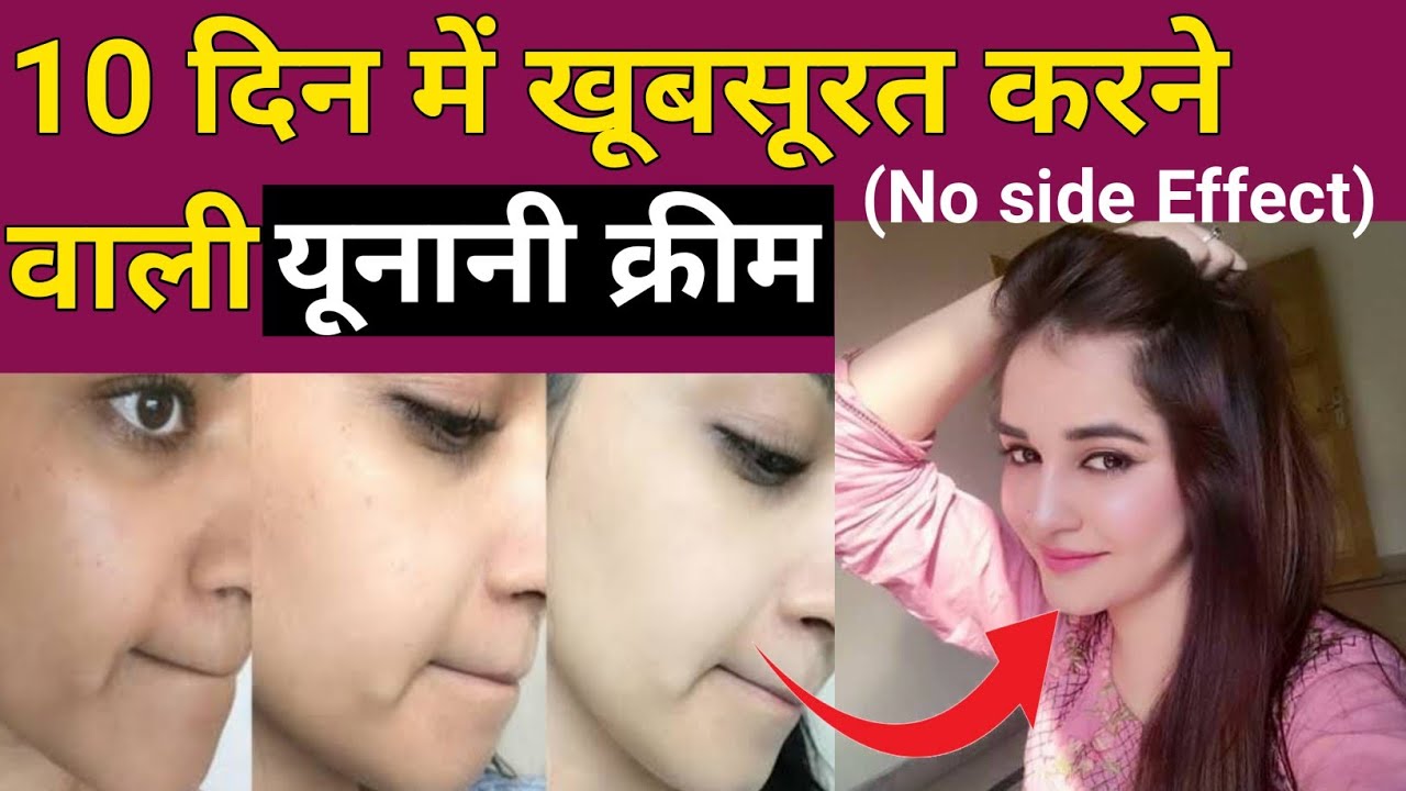 Face ko Gora karne ki cream Skin Whitening cream How to Glowing