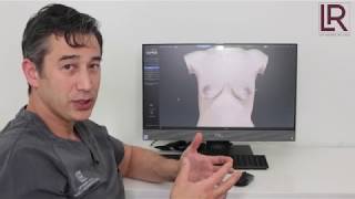 Dr. Leif Rogers uses the Vectra 3D Imaging Camera to Simulate a Breast Augmentation with Implants