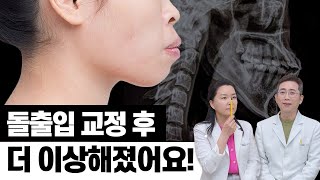 돌출입 교정 후 매력이 떨어진 이유는 무엇일까요?!