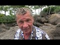 Claudius Fabig berichtet über eine Aknestudie der Charite! So gesund ist Sonne!