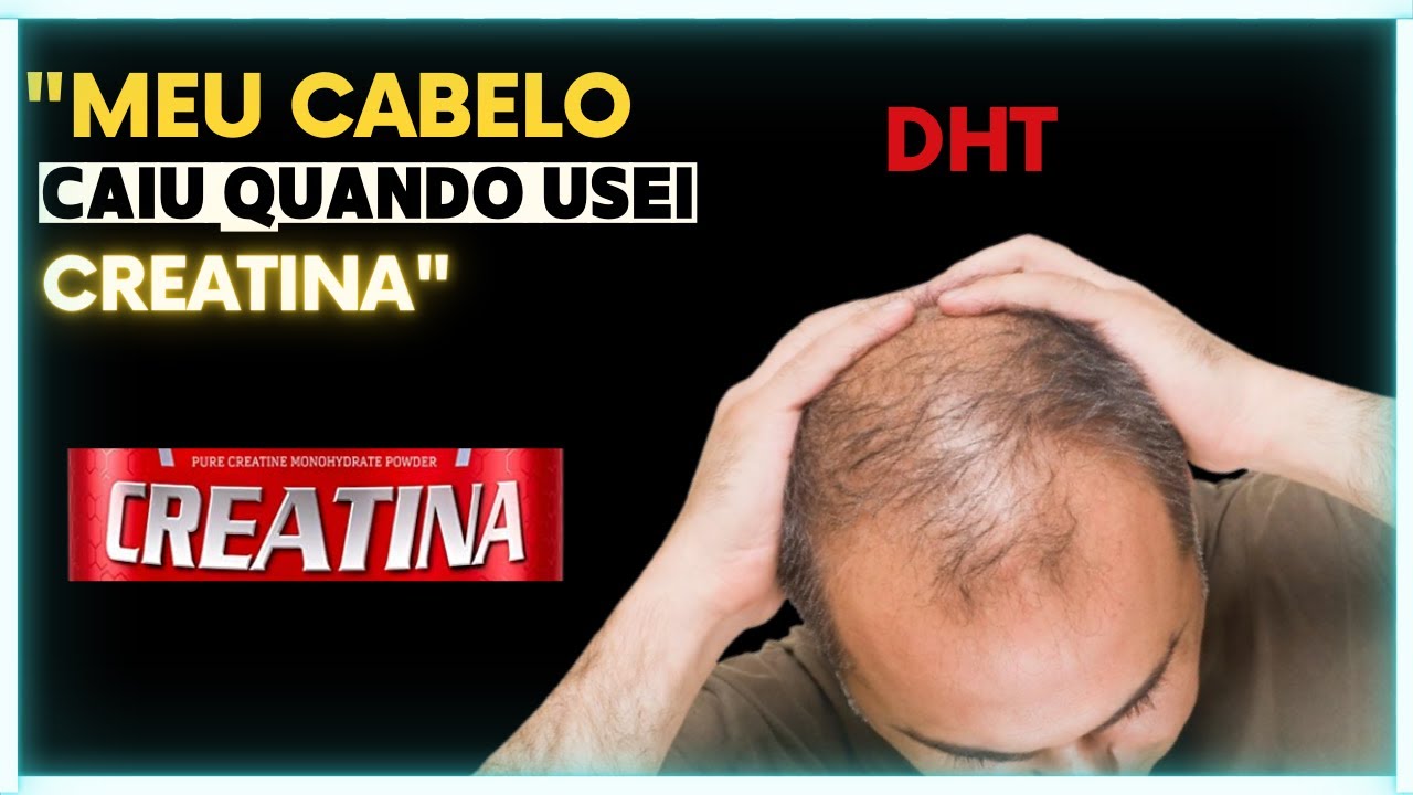 CREATINA ME CAUSOU QUEDA DE CABELO, E AGORA? Calvície masculina