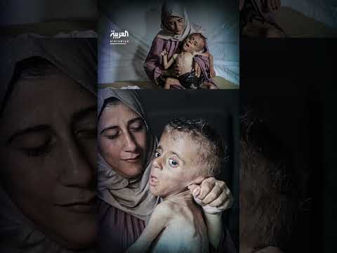 غلاف نيويورك تايمز يثير جدلاً حول الجوع في غزة