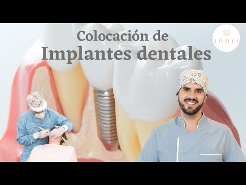 Colocación de Implantes