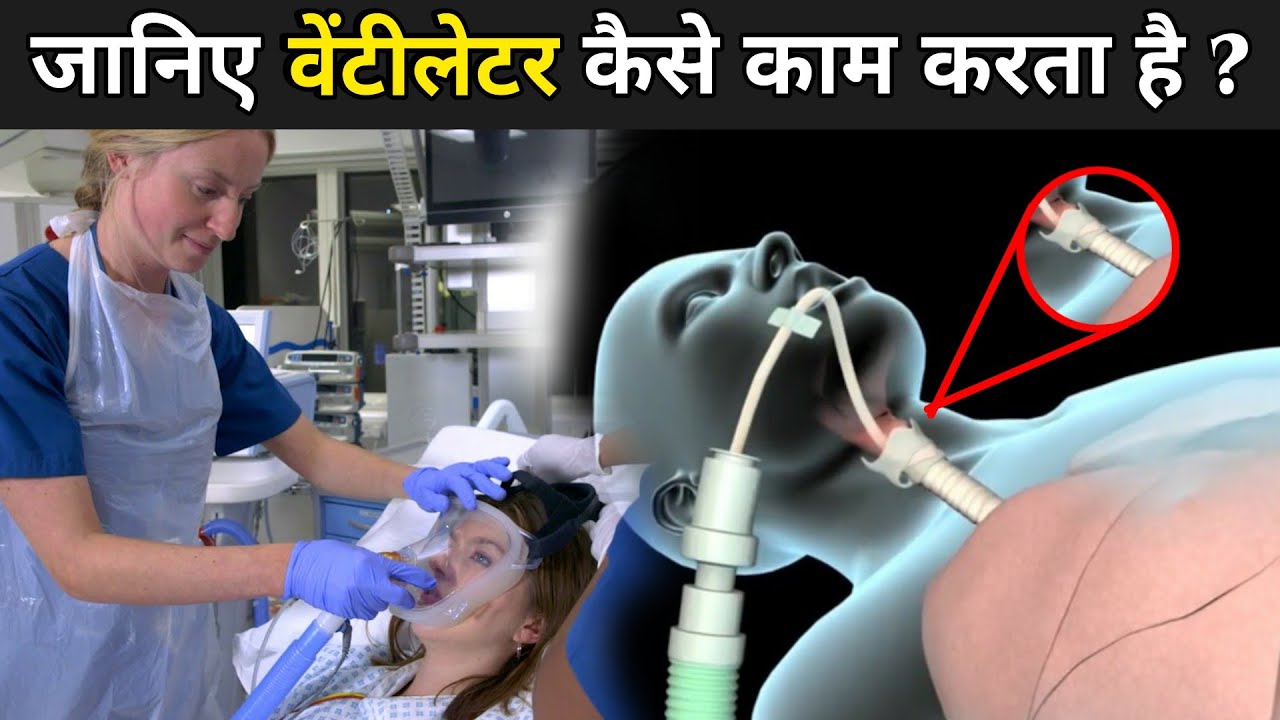 जानिए वेंटीलेटर क्या है और कैसे काम करता है ? Ventilator Machine In
