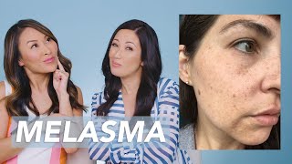 Dark Spots and Melasma Removal Skincare Routine for New Mom Kâté!
