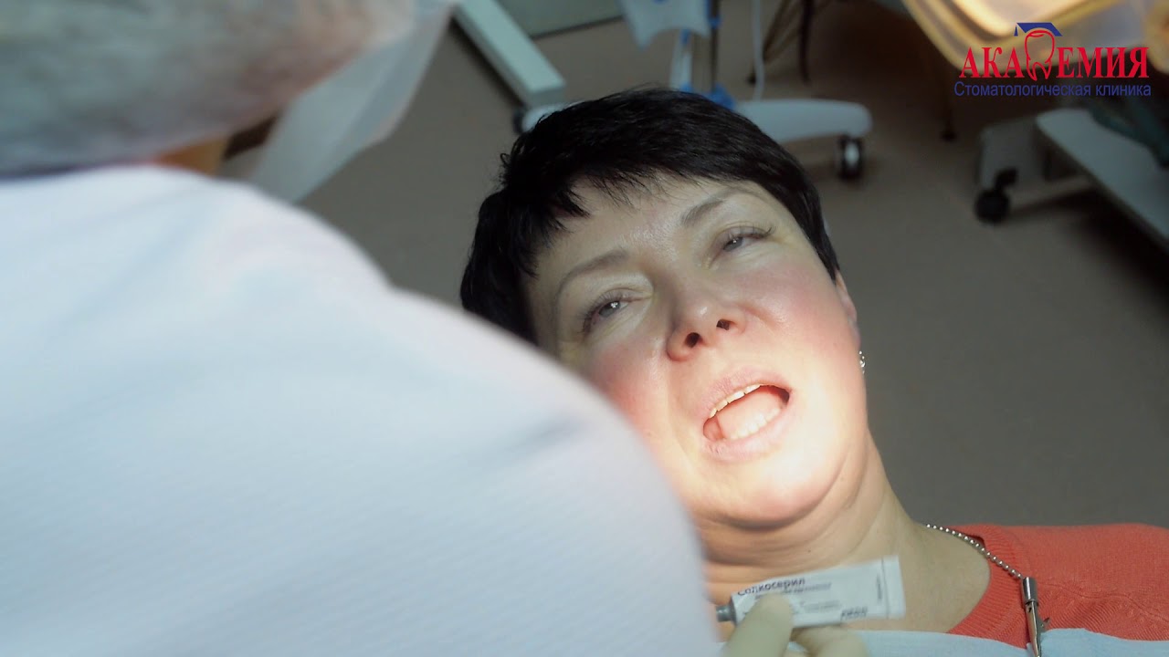 УДАЛЕНИЕ ЗУБА