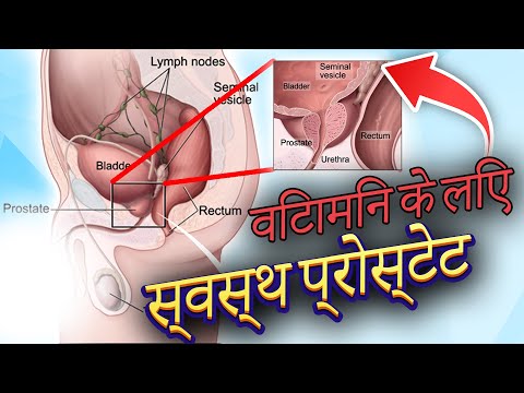 वीडियो: गर्म मौसम में कैसे कपड़े पहने: 12 कदम (चित्रों के साथ)