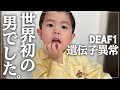 世界初の症例でした。遺伝子異常に気づくまで。この子は何かが違う…母の勘は当たる。
