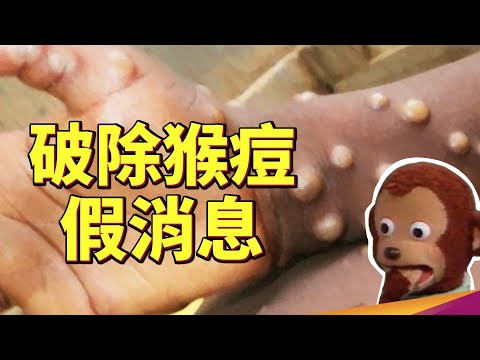 台灣本土猴痘加強檢疫！猴痘疫情WHO認定為國際公衛緊急事件！