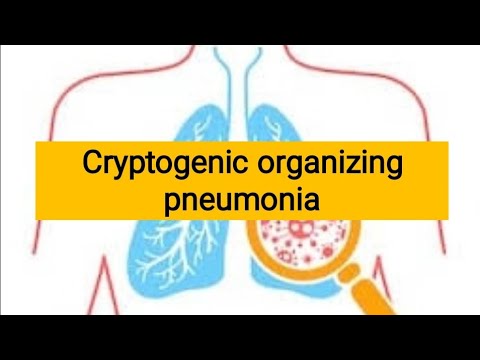 Cryptogenic organizing pneumonia |Restrictive lung Diseases - YouTube