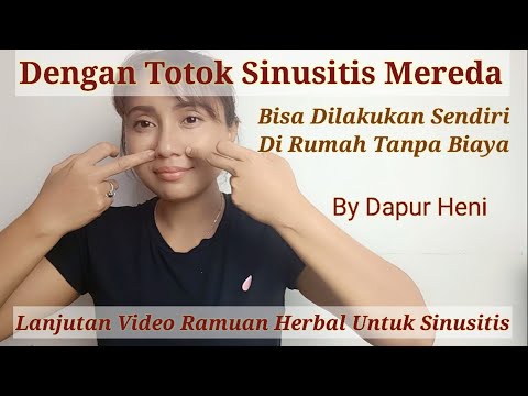 Cara Meredakan Sinusitis Dengan Metode Totok Tanpa Biaya Bisa Dilakukan Sendiri Di Rumah