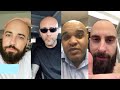 BALD MEN Tell You How They Accepted Their Hair-loss And Went Bald