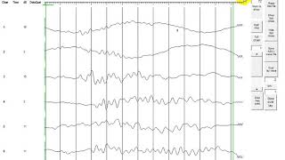 Cross hole data analysis