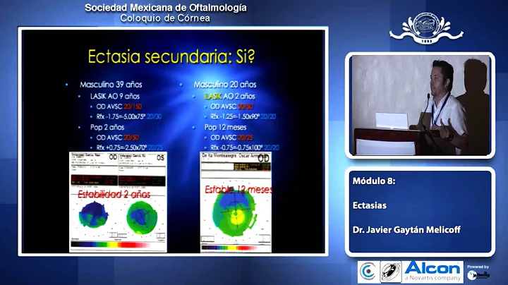 Mdulo 8: "Ectasias", Dr. Javier Gaytn Melicoff - C...