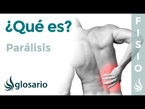 Vídeo: Parálisis Muscular: Parálisis Flácida, Bulbar, Erba, Bella, Espástica