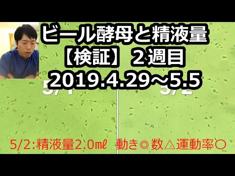 アサヒスーパービール酵母zで朝の目覚めがすっきり きのこのブログ スーパービール酵母z Hashtag On Twitter