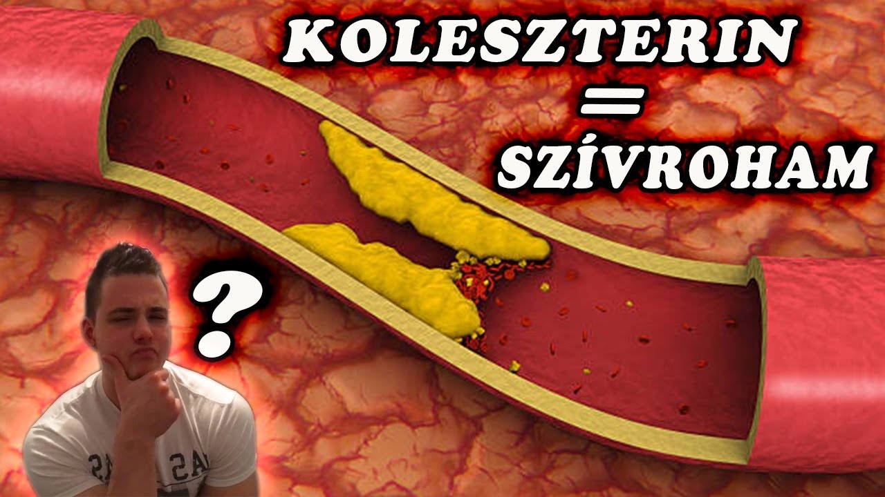 koleszterin hipertónia és diabetes mellitus esetén