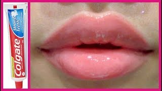 Dudağınıza Colgate Sürün ve Bekleyin. Sonuca İnanamayacaksınız.