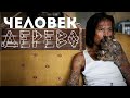 Человек-дерево | Самая странная болезнь