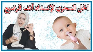 العلاج السحري لانسداد أنف الرضيع قناة دكتورة وفاء عبدالله