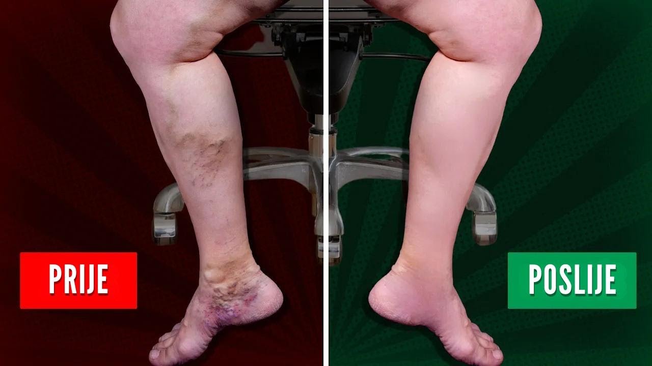 5 vježbi za bolju cirkulaciju u nogama dok sjedite na poslu