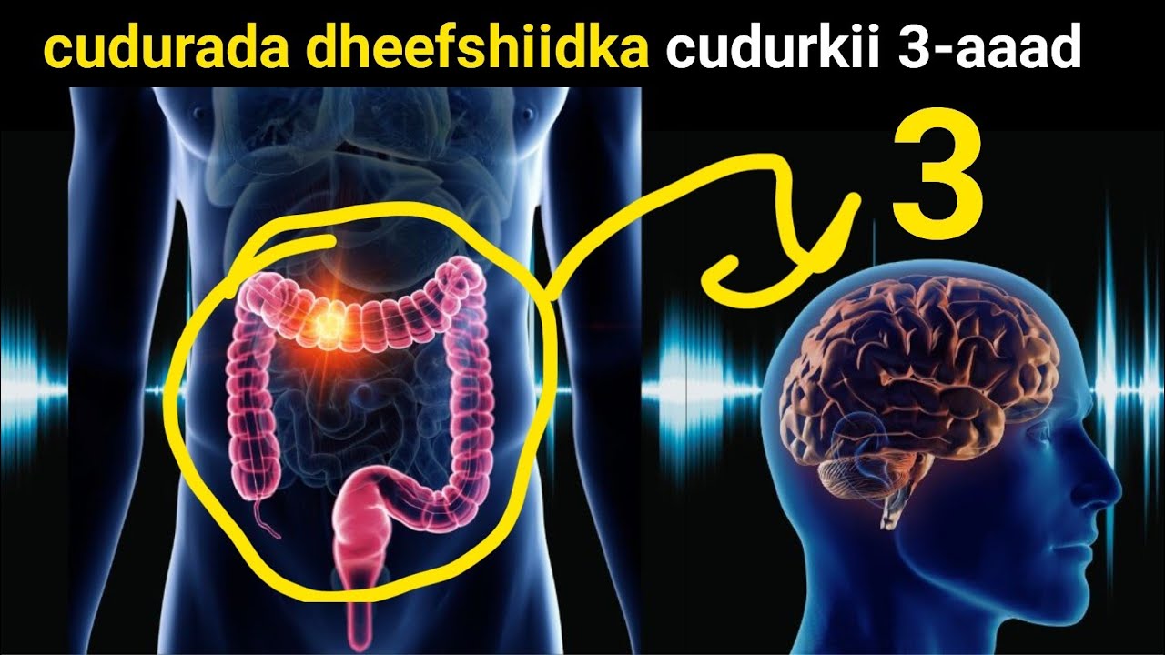 Taxanaha Xanuunada ku dhaca dheef-shiidka qeeybtii 3-aaad with Dr Timajilac