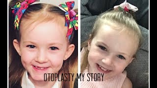 Otoplasty, MY Story, before &amp; after my decision to have surgery at 6 years old ears pinned back