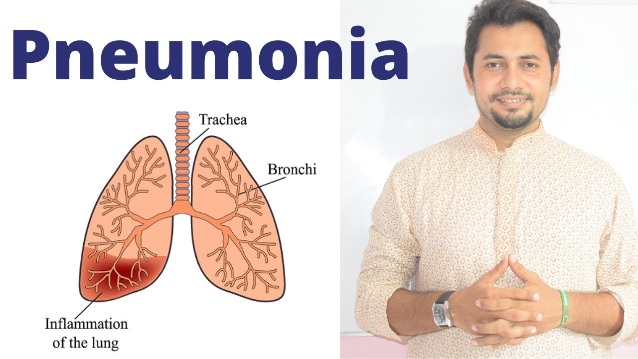 Pneumonia Lung Disease Exchange of Gases English Version Fahad