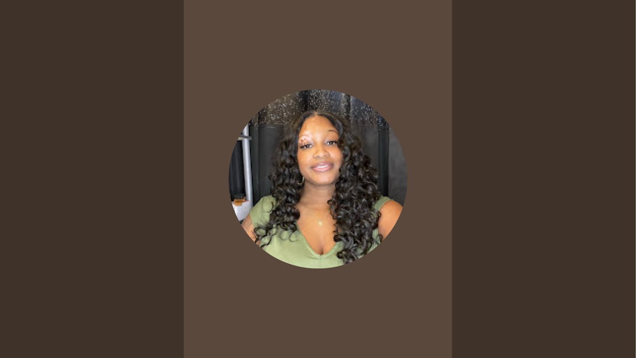 “Vitiligo Goddessz” is live!